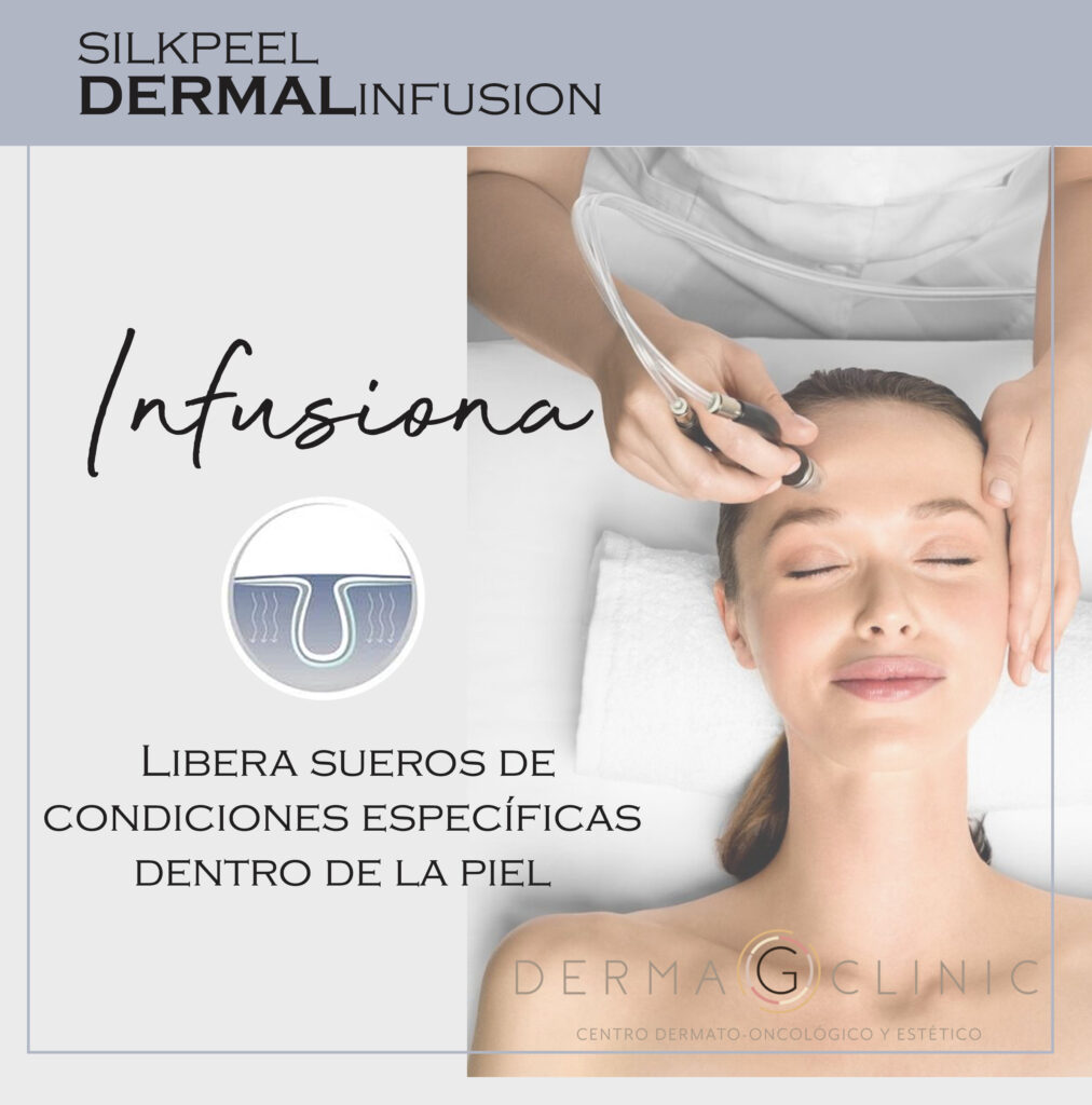 skillpeel Infusiona2